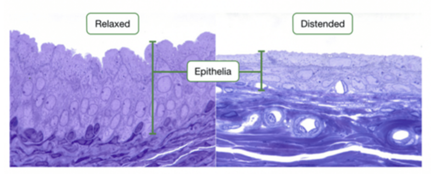 <p>- A special type of stratified epithelium that can change shape when stretched (distension) and return to its original form due to elasticity.</p><p>- Cuboidal or columnar shape at the base, and when it stretches it becomes a squamous shape. (It is the same cell, just can become a different type) because shape determine what type of cell it is. </p><p>- Location: Bladder, uterus, and upper urethra (allows us to fill bladder).</p>