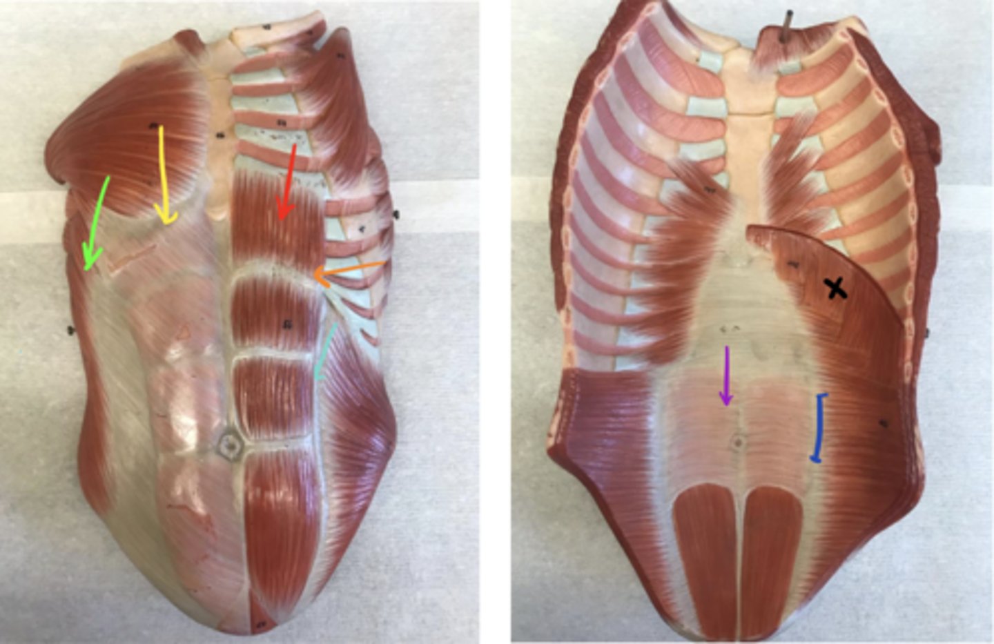 <p>ID the structure of the orange arrow.</p>