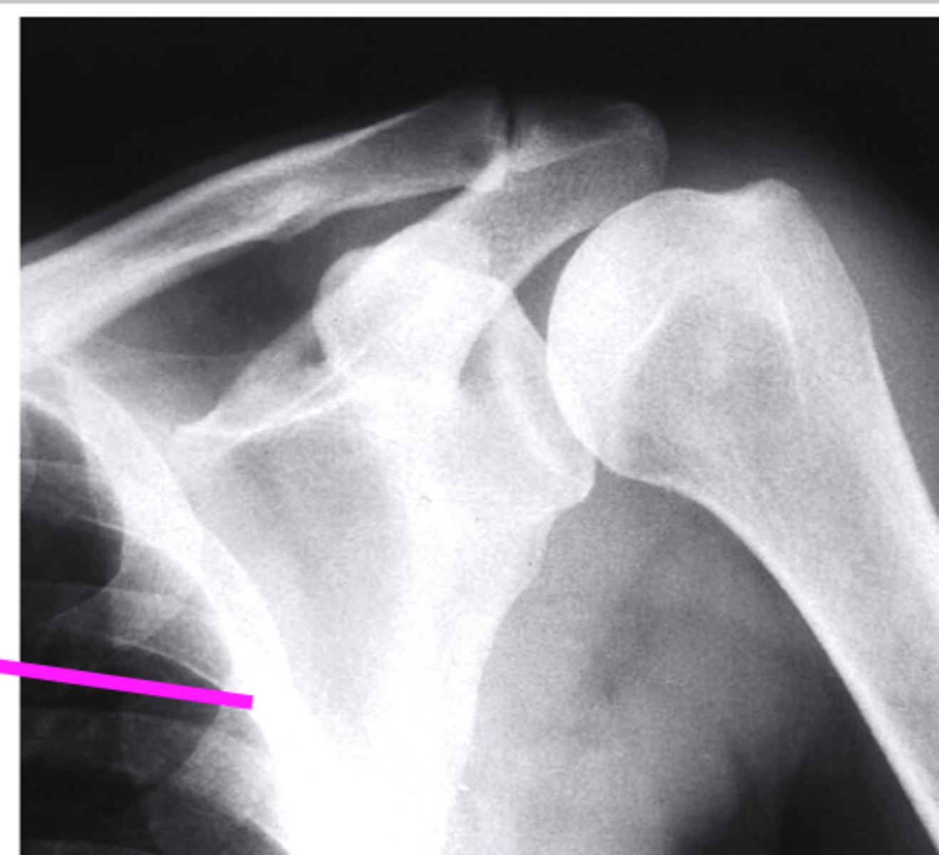 <p>what does the pink line point to?</p>