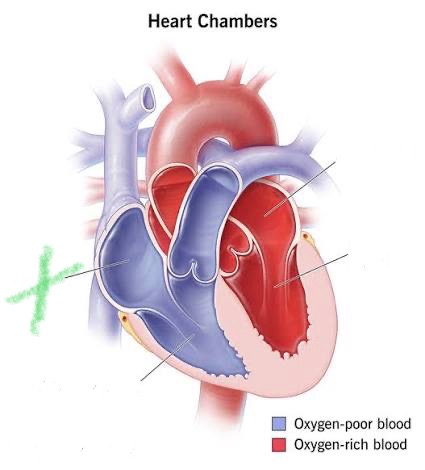 <p>Upper right chamber; receives deoxygenated blood from superior and inferior vena cava.</p>