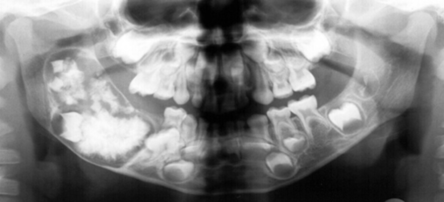 <p>ID the pathology:</p>