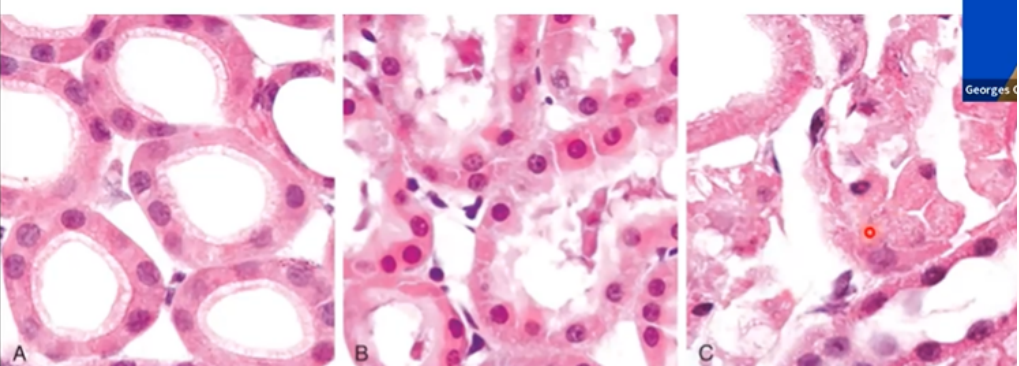 <p>Describe the injury in this image (A, B, C)</p>