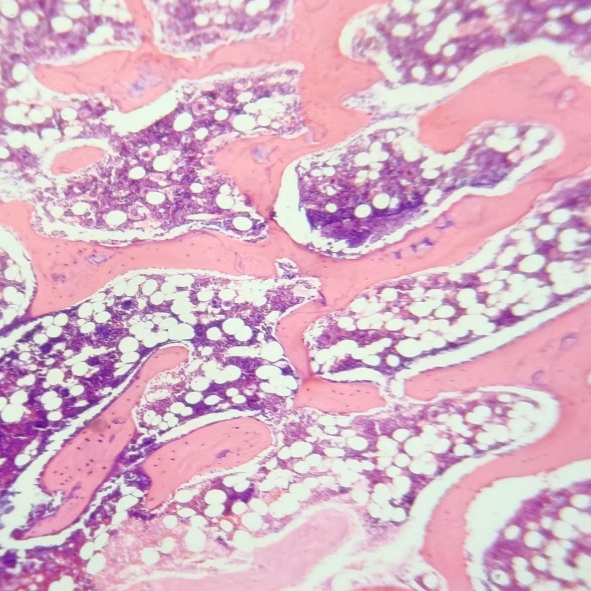 <p>Identify this type of connective tissue: </p>