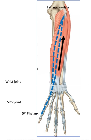 <p>Name this muscle</p>