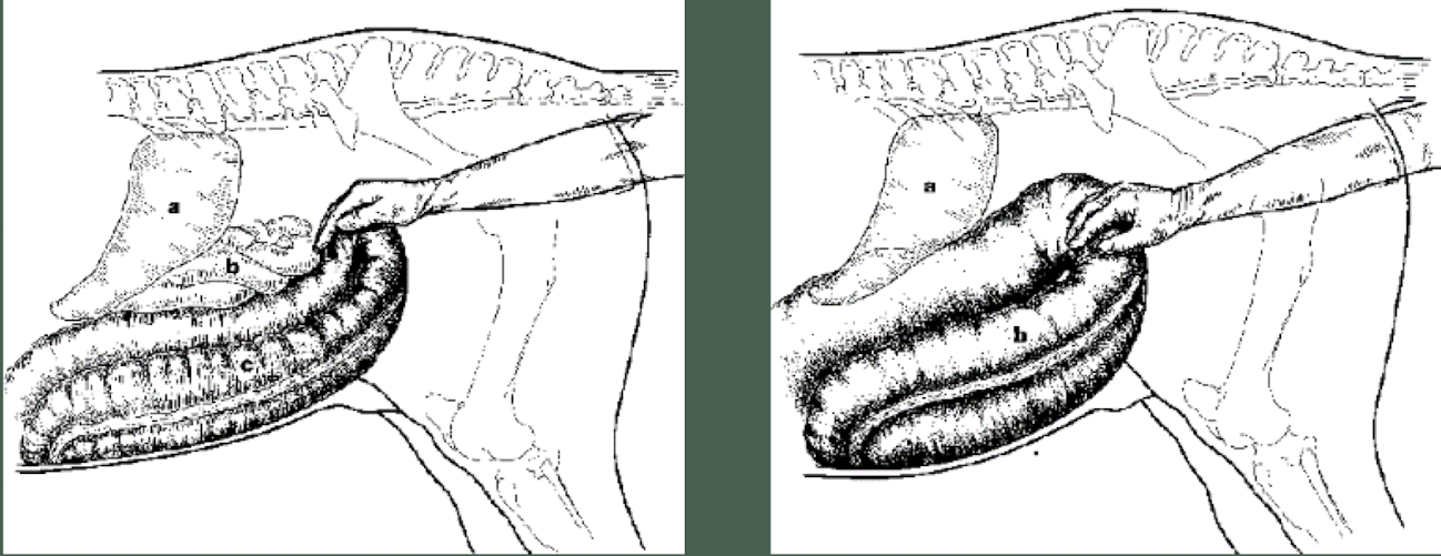 <p>What is being palpated in this picture?</p>