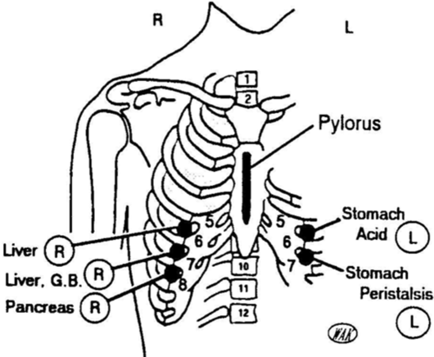 <p>anterior: 6th ICS on right</p><p>posterior: T6 on right</p>