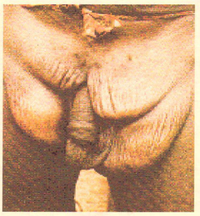 <p>Disease; caused by?</p>