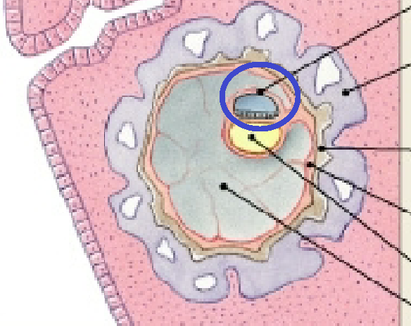 <p>amniotic fluid protects fetus</p>