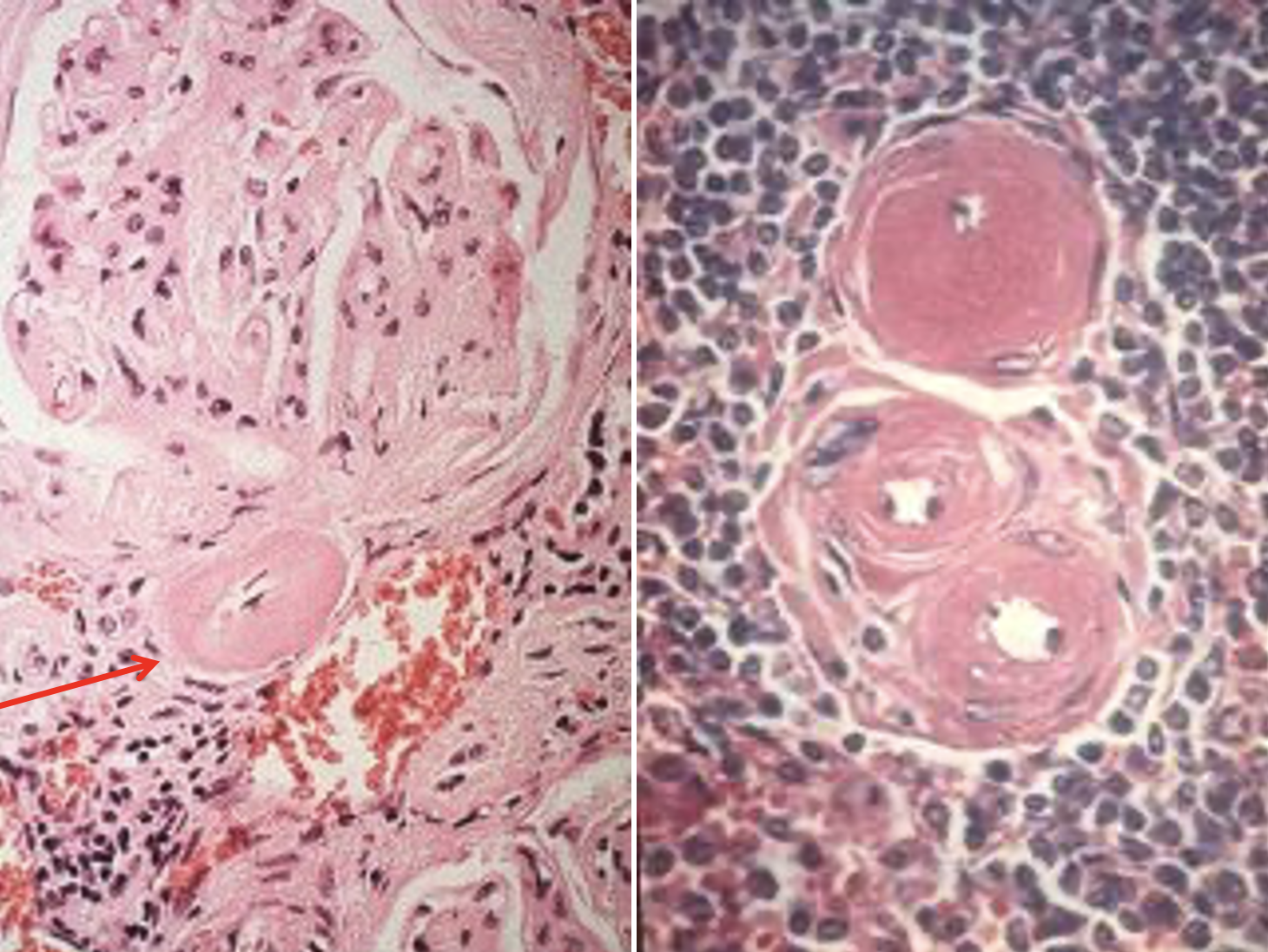 <p>What pathology is shown in these images?</p>