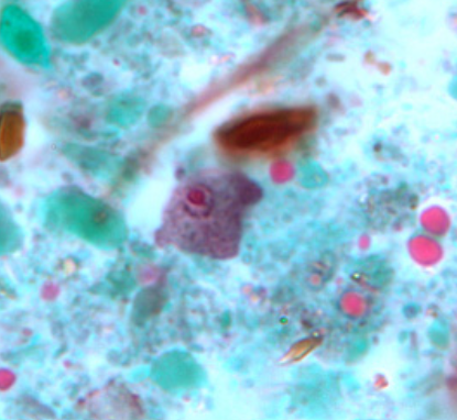 <p>Identify organism and stage</p>
