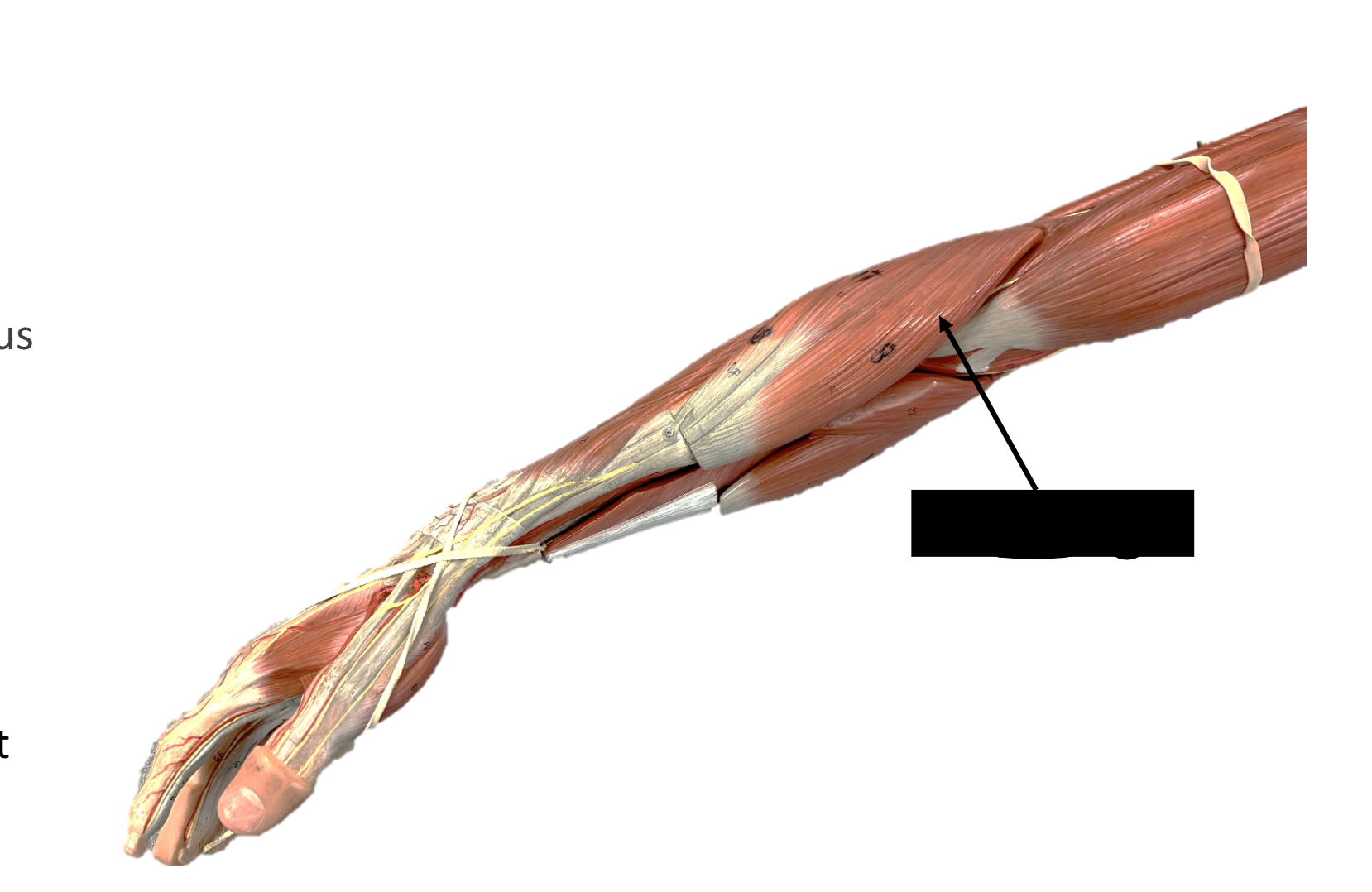<p>Origin: lateral epicondyle of humerus</p><p>Insertion: styloid process of the radius</p><p>Function: flexes forearm at the elbow joint</p>