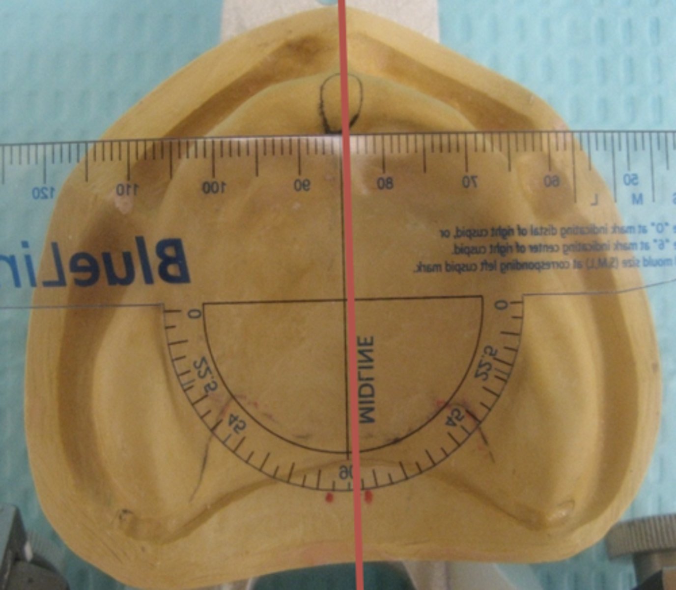 <p>When placing the transparent ruler over the center of the incisive papilla, the front edge of the ruler should be perpendicular to what structure?</p>