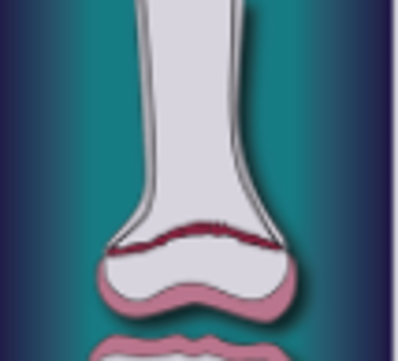 <p>What injury is this</p>