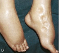 <p>Which health conditions are commonly associated with this figure?</p>