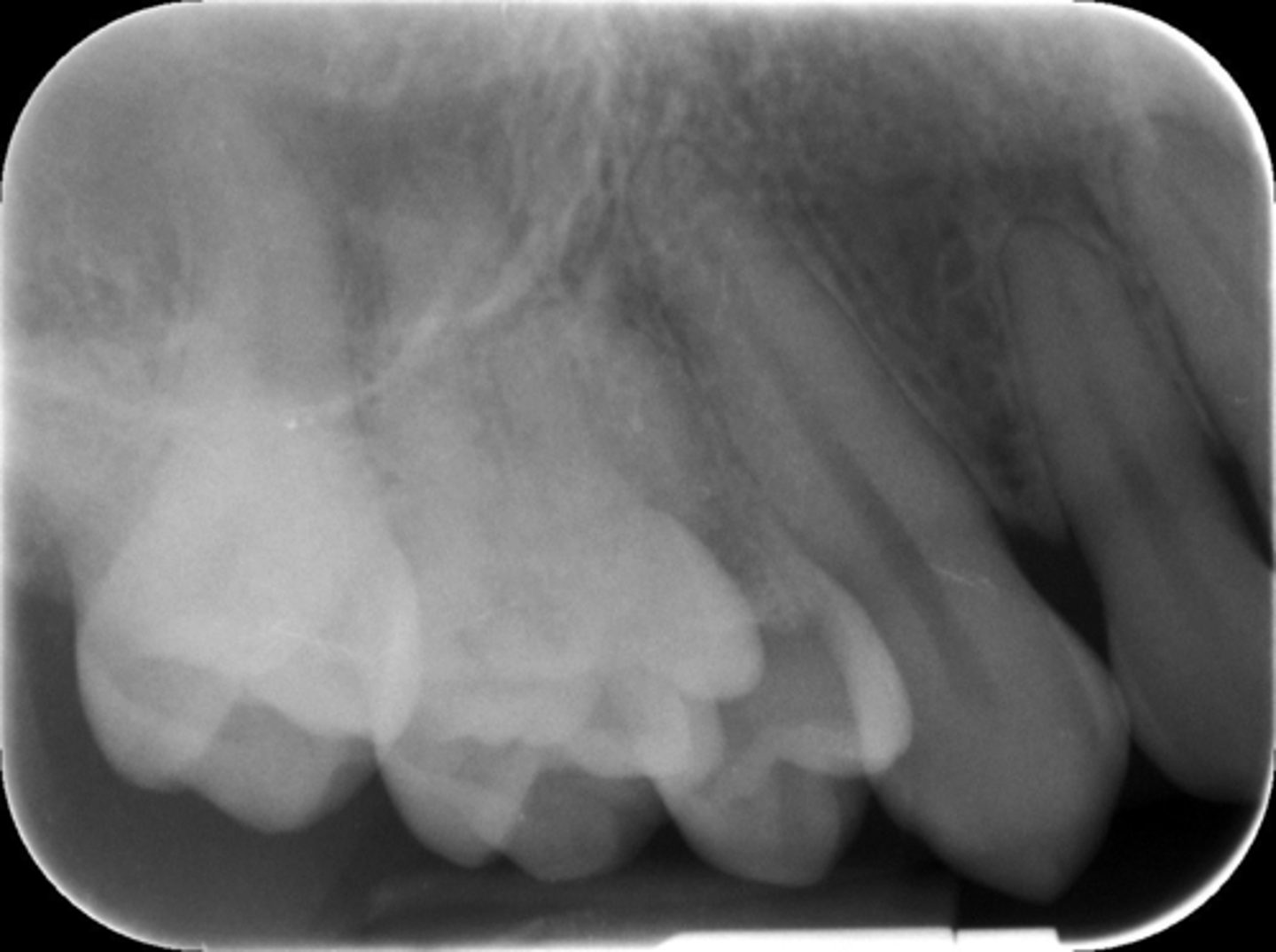 <p>What is this error?</p>