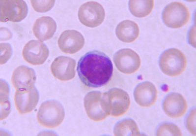 <p>which leukocyte is this?</p>