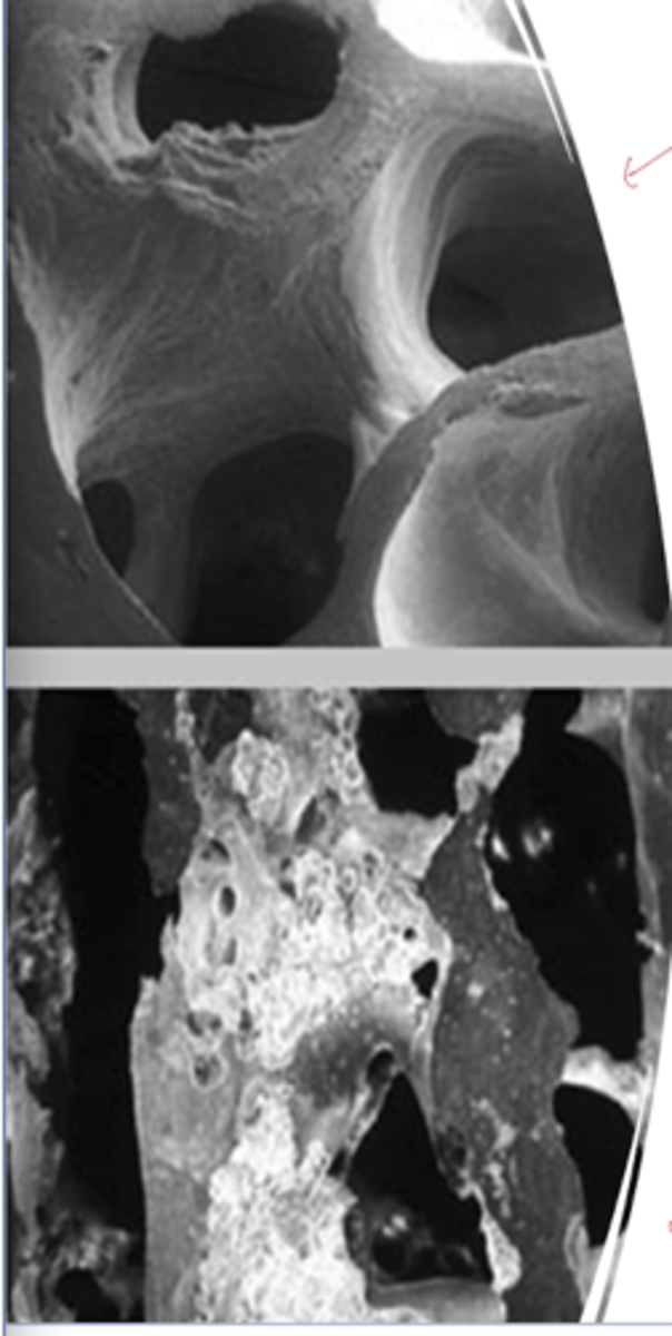 <p>imaging - mosaic pattern --&gt; disordered formation</p>