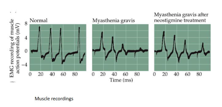 <p>Neostigmine treatment </p>