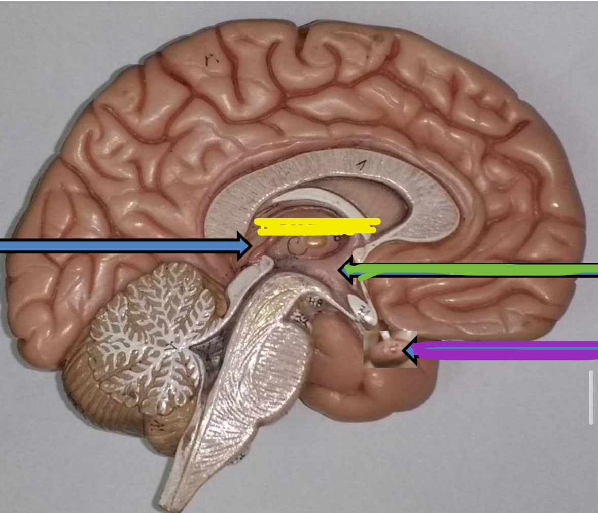 <p>Blue points to what part of the diencephalon</p>