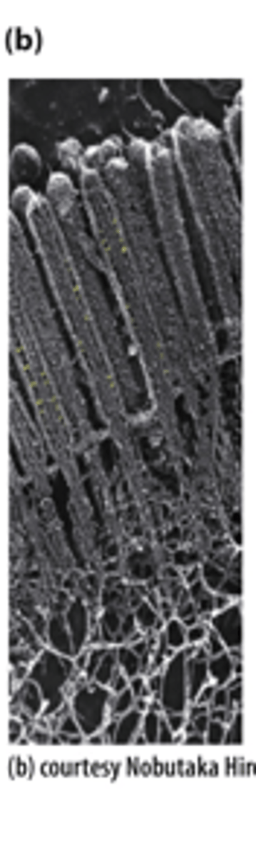 <p>The apical region of a polarized epithelial cell, showing the microvillar core bundles of _________ _________________ (Sample was prepared using a rapid freeze, deep etch, rotary shadow protocol and viewed by transmission electron microscopy.)</p>
