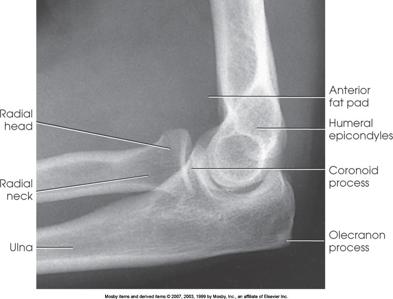 <p>What position is demonstrated?</p>