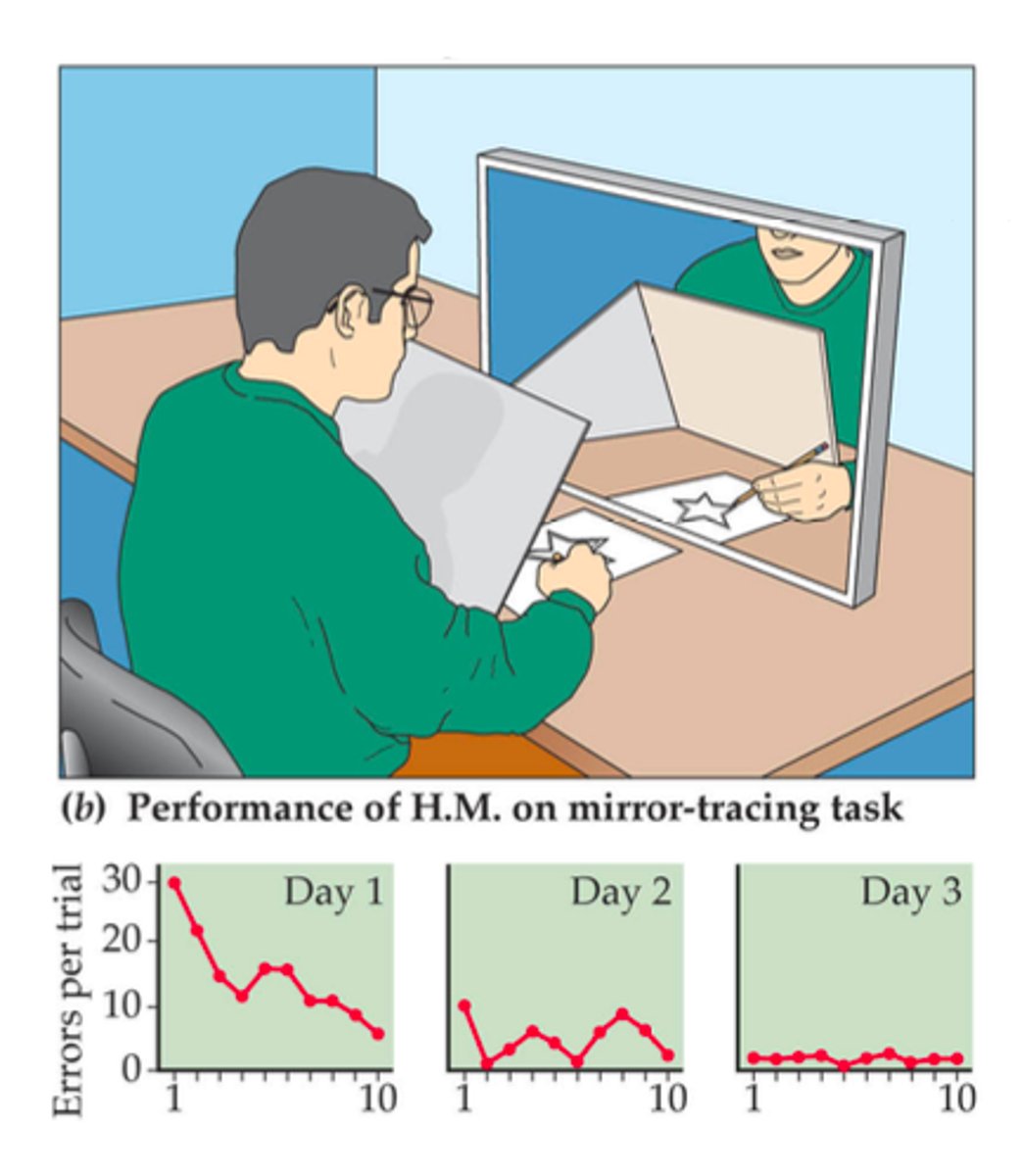 <p>1) New motor skills</p><p>2) Perceptual learning</p><p>3) Working memory</p><p>4) Classical conditioning</p>