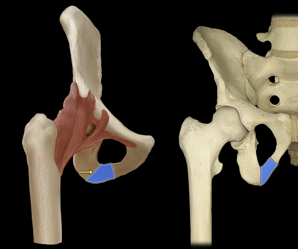 <p>Ischial ramus</p>