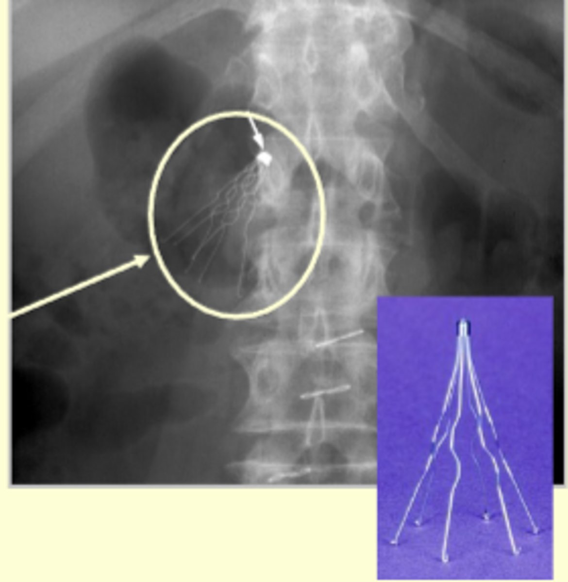 <p>Diagnose and Treatment</p>