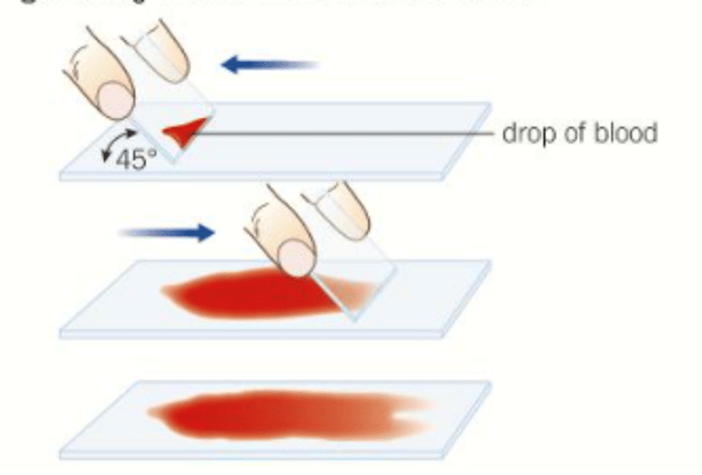 <p>the edge of a slide is used to smear the sample, creating a thin, even coating on another slide, over which a cover slip is placed, e.g. blood.</p>