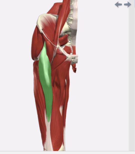<p>Rectus Femoris</p>