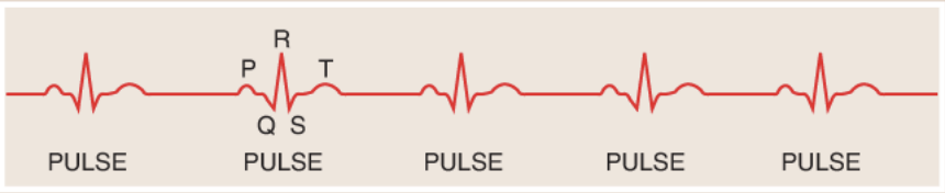 <p>The electrical impulses associated with a single heart beat: the P, Q, R, S, and T waves</p>