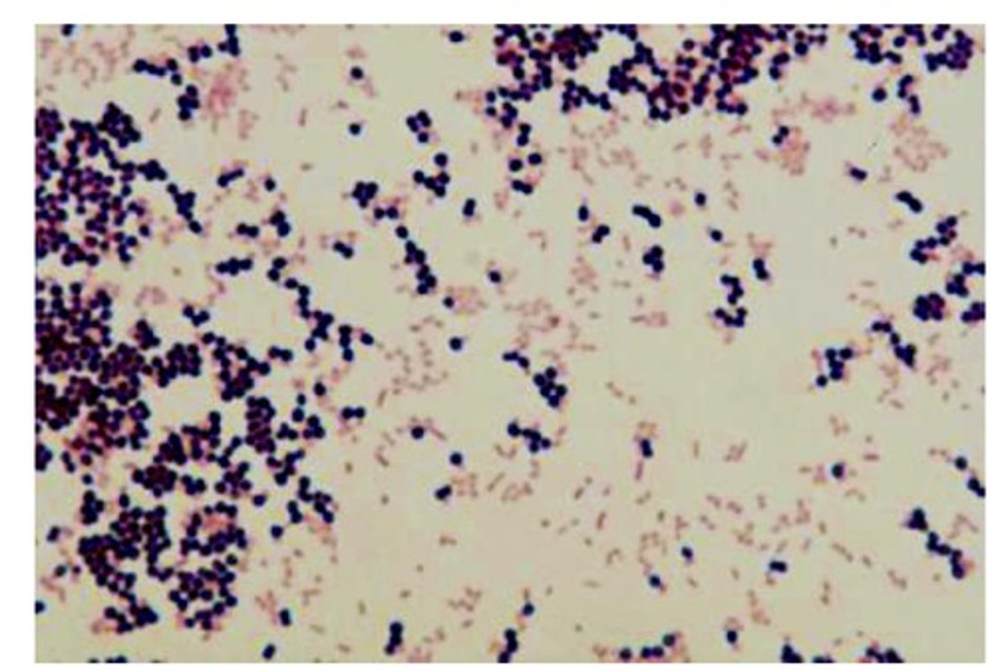 <p>Purple -- THICK cell wall</p>