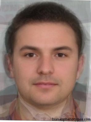 <p>Identify this Phenotype</p>