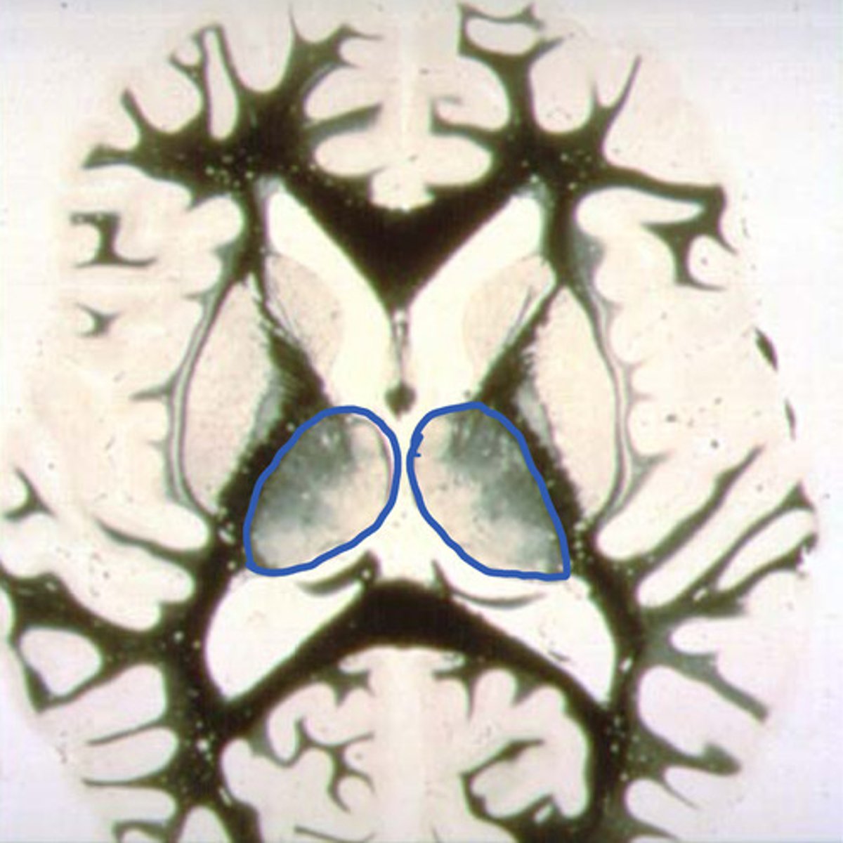 <p>identify the structure</p>