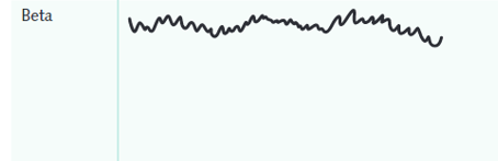 <ul><li><p>Low amplitude and high frequency</p></li></ul><p></p>