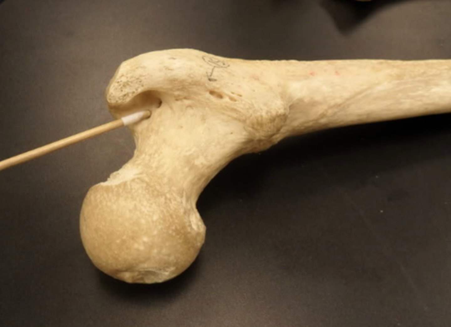 <p>trochanteric fossa of femur</p>