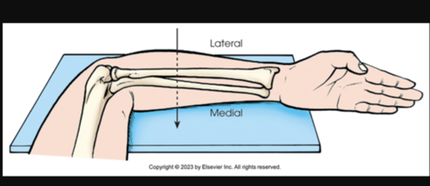 <p>X projection of forearm. Central ray enters lateral aspect of forearm and exits medial aspect.</p>
