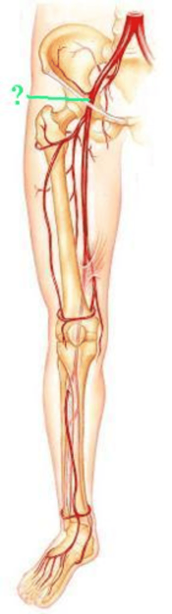 <p>Identify the indicated blood vessel.</p>