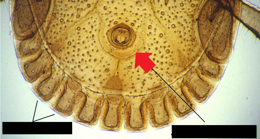 identify the pointed structure