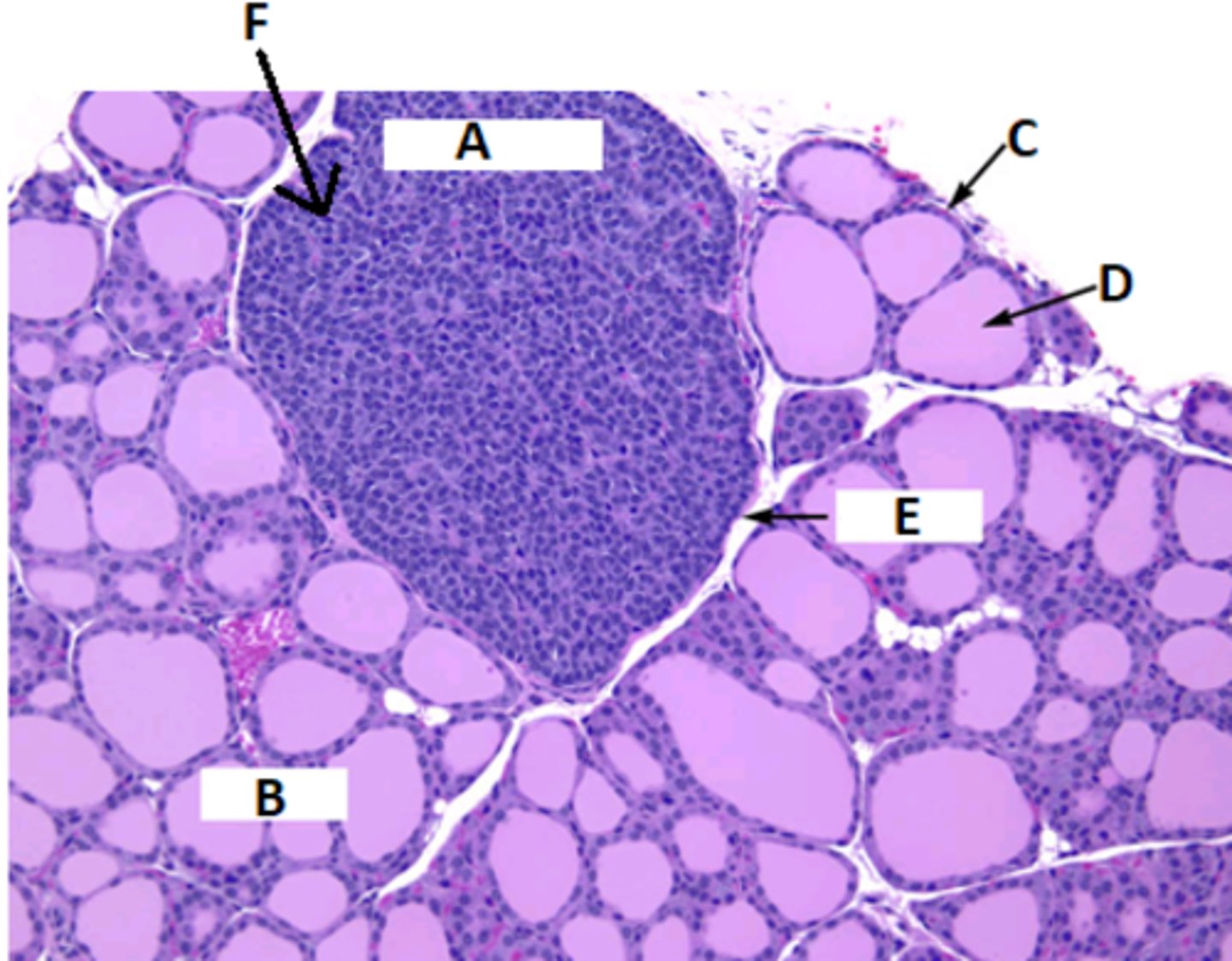 <p>Label this histological slide of the thyroid and parathyroid gland</p>