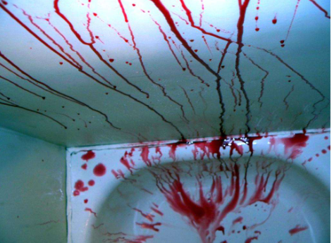 <p>What bloodstain pattern is this?</p>