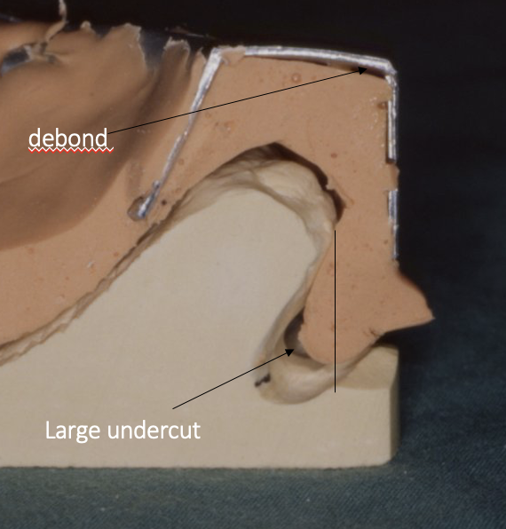 <p>what are disadvantages of alginate </p>