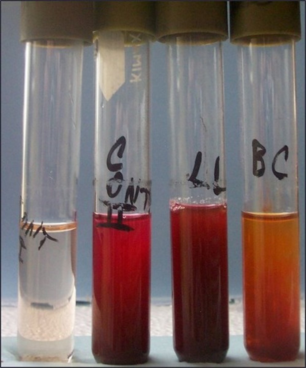 <p>Reagents for this test, what it :</p>