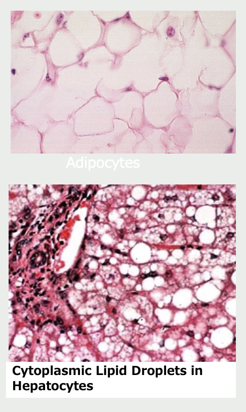 <p>fat droplets</p><ul><li><p>found in</p><ul><li><p>adipocytes (fat cells)</p></li><li><p>steroid hormone producing cells</p></li><li><p>some types of glands</p></li></ul></li><li><p>extracted during processing so appear vacuoles</p></li></ul><p></p>