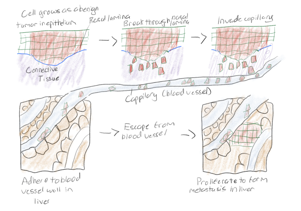 <p>Abnormal cells spread to distant locations to form new tumors</p>