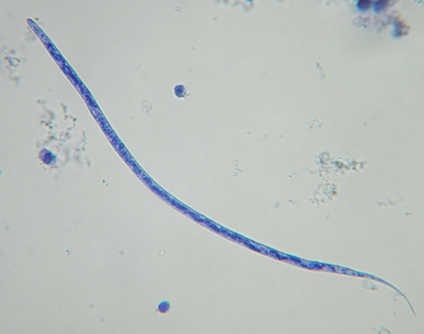 <p>Size must be >300 um</p>