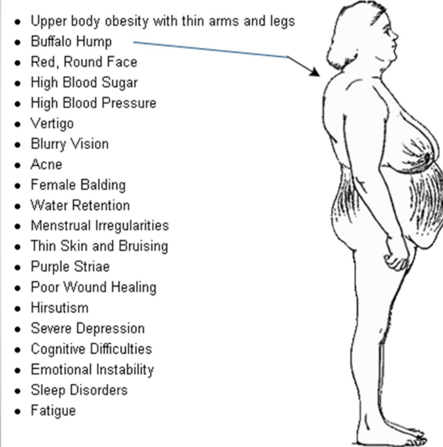 <p>Cushing Syndrome</p>