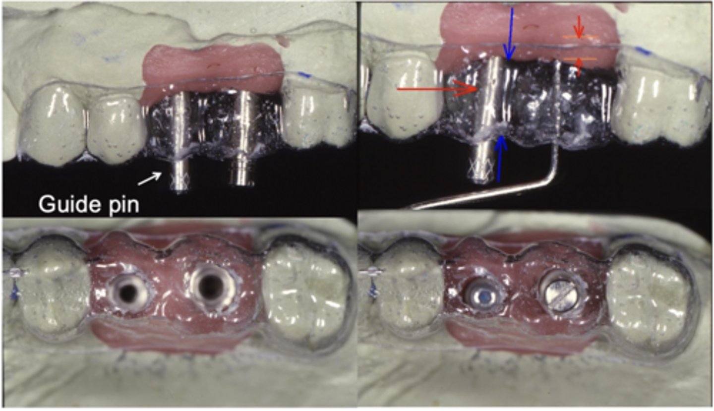 <p>What do you have to check on the implants in relation to intended restorations?</p>