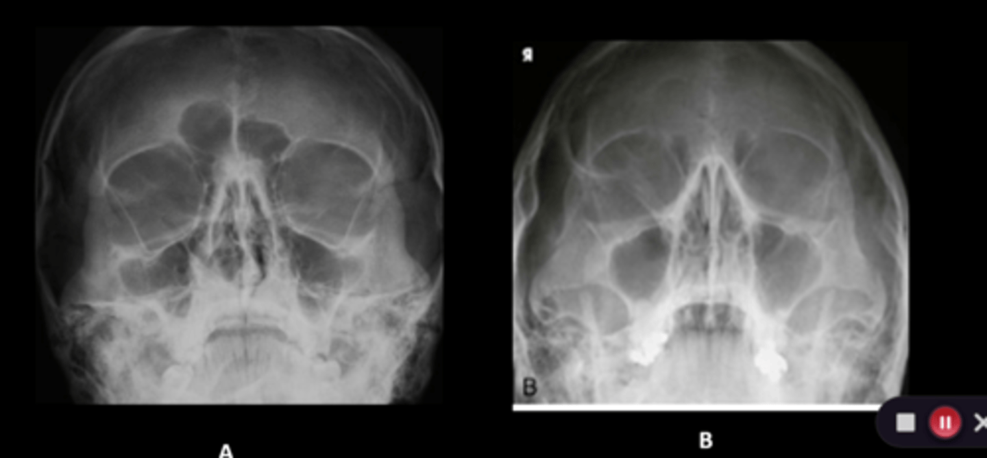 <p>Which image is the modified waters?</p>