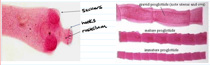 <ul><li><p><span>Scolex: head</span></p><ul><li><p><span>Suckers &amp; Hooks</span></p></li></ul></li><li><p><span>Rostellum (not all have this)</span></p></li><li><p><span>Proglottids: individual segments</span></p></li><li><p><span>Strobila: string of proglottids</span></p><ul><li><p><span>1/3 are mature, 1/3 are immature, 1/3 are gravid</span></p><ul><li><p><span>Gravid: sexually mature and producing infective eggs</span></p></li></ul></li></ul></li></ul><p></p>